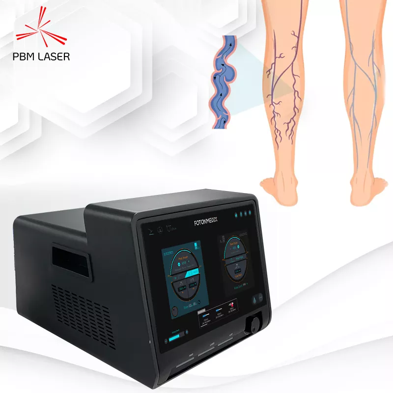Endovenoosne laserkirurgia